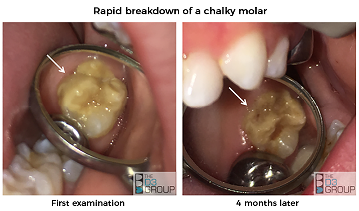 Rapid Breakdown image