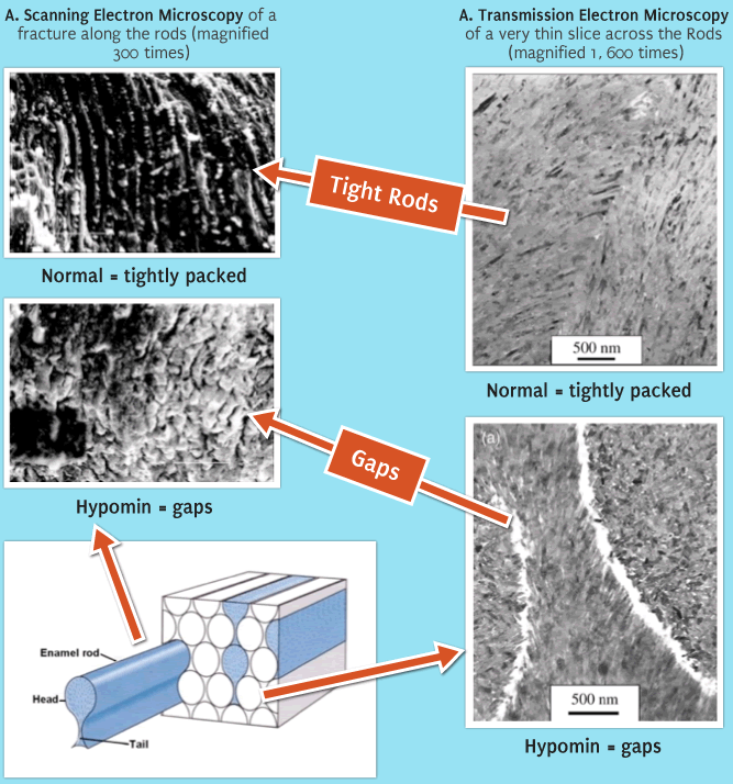 A.Scanning Electron Micorscopy