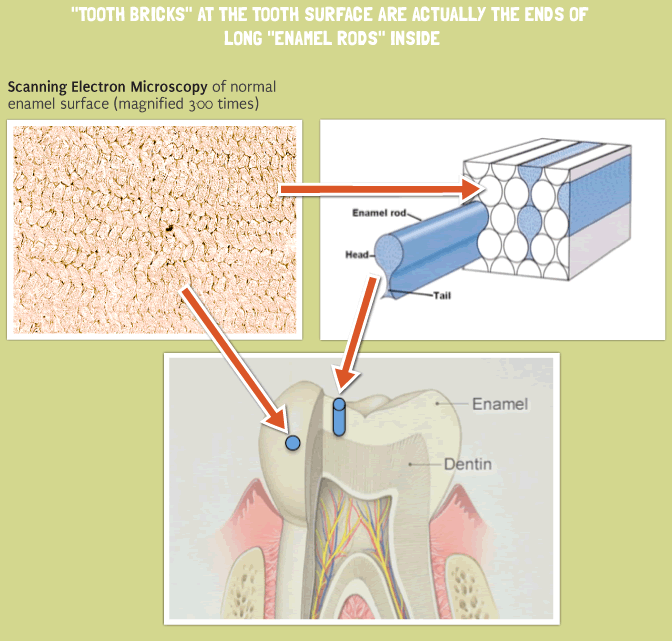 Tooth Bricks at the tooth surface Tooth Bricks at the tooth surface