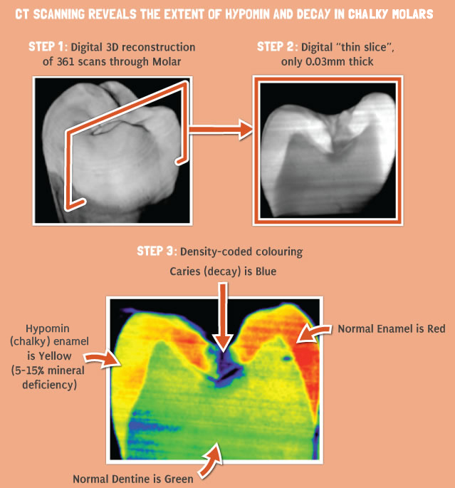 CT Scanning