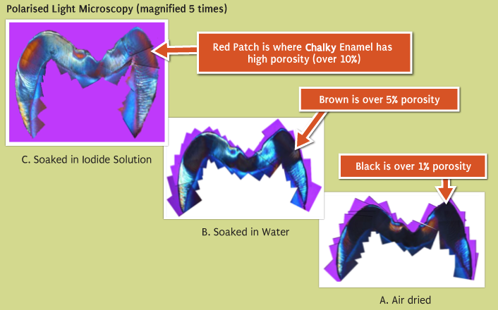 Polarised Light Microscopy