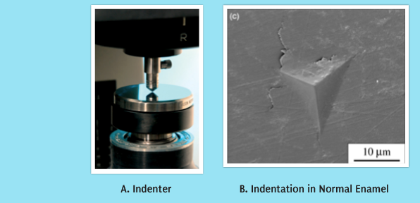 A.Indenter B Indentation in Normal Enamel