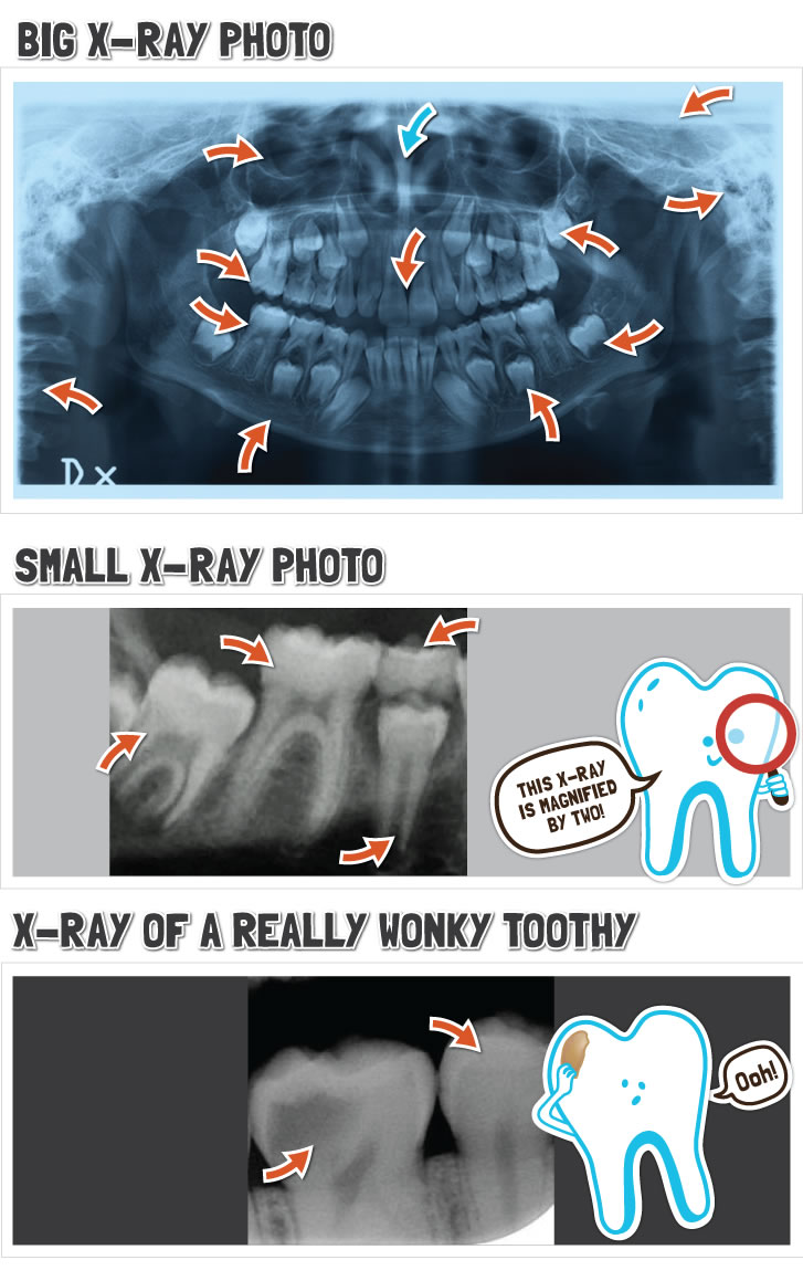 X Ray Base