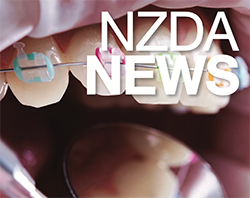 NZDA News Front Cover Pic