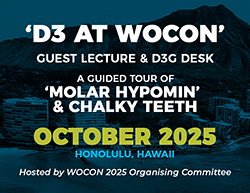 WOCON pic